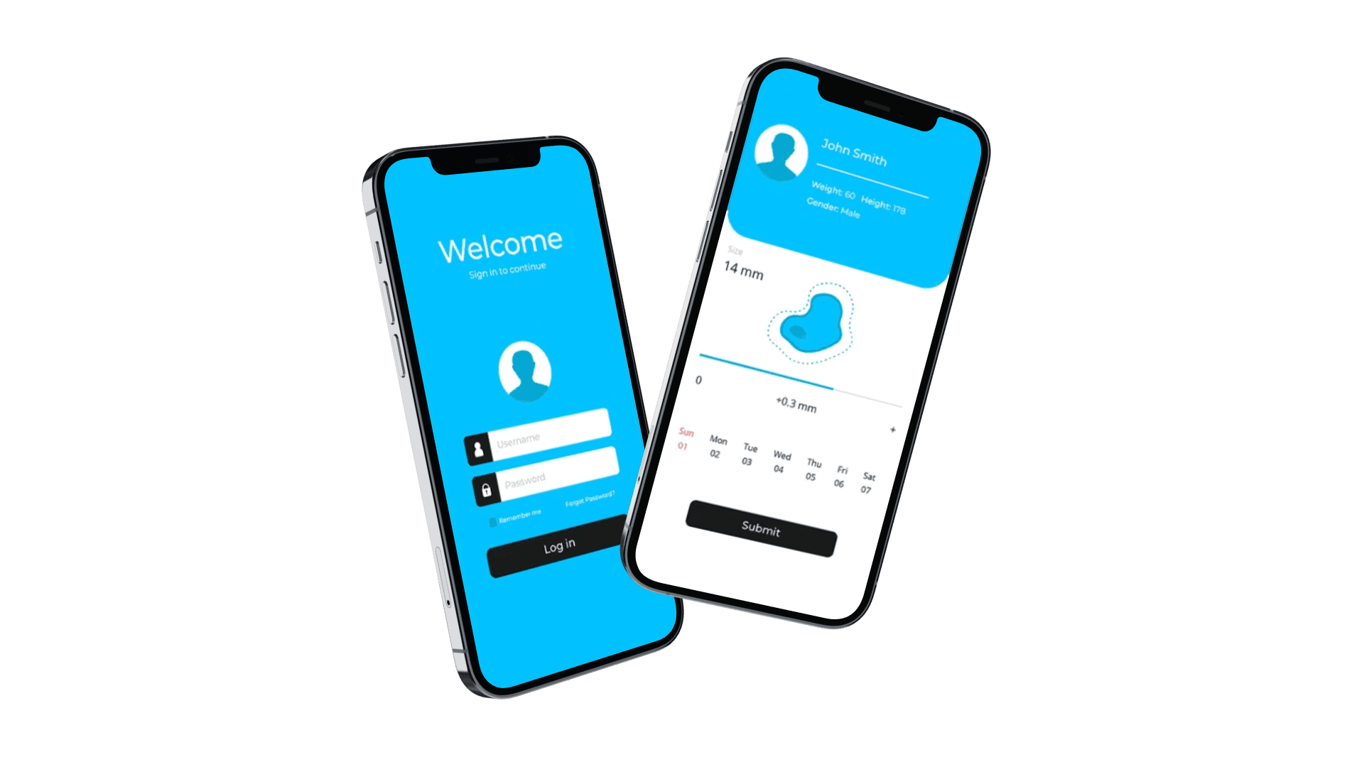 Automated melanoma prevention and detection app UI showcase